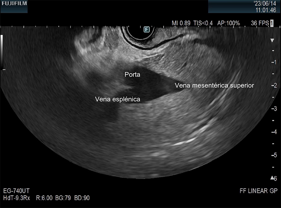 curso-palencia-endoscopia